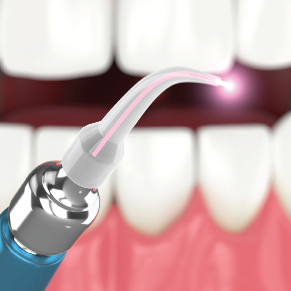 العلاجات القائمة على الليزر