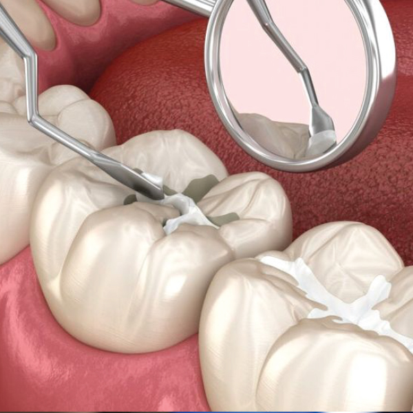 خدمات طب الأسنان الابتدائية