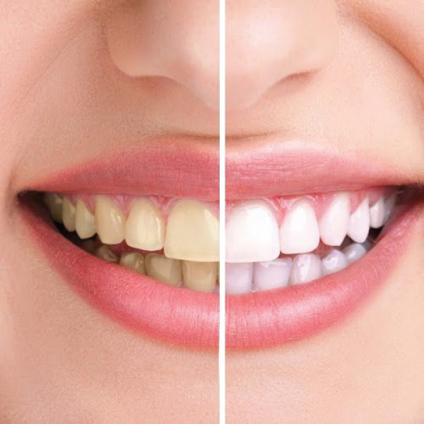 العلاج التجميلي_